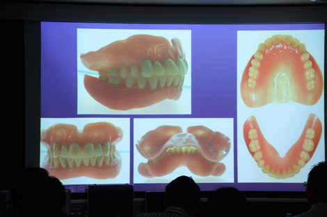 150621総義歯の基礎と臨床