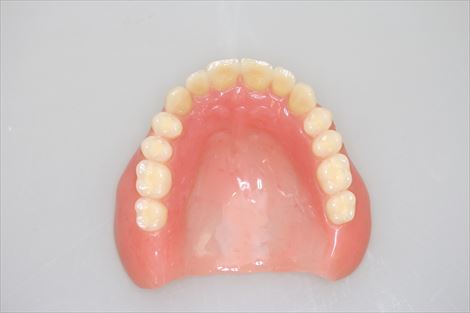 金属床を使わない、自費の総義歯をどのように患者さんに勧めたらよいでしょうか