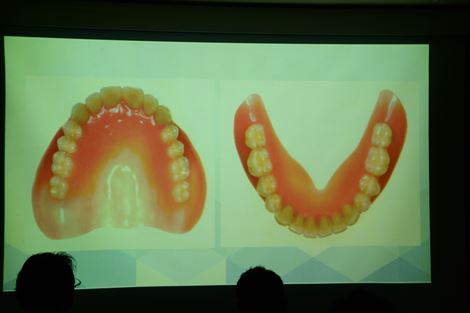 総義歯の基礎と臨床