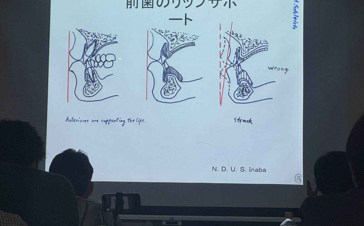 筋機能療法エントレセミナー 開催報告〜咬合認定医 第10期 第6回〜