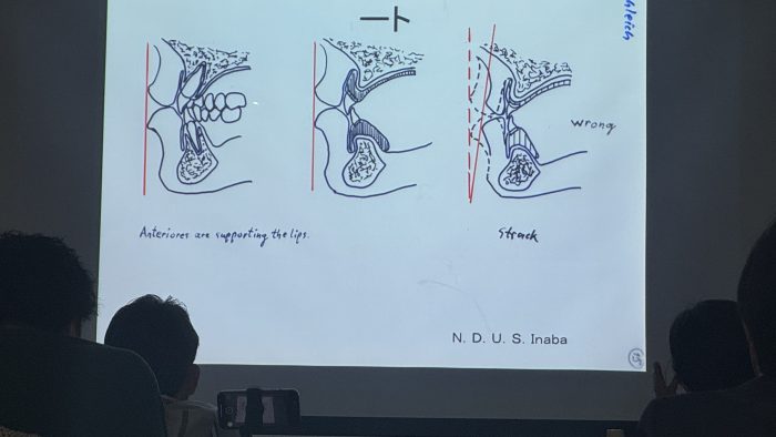筋機能療法エントレセミナー 開催報告〜咬合認定医 第10期 第6回〜